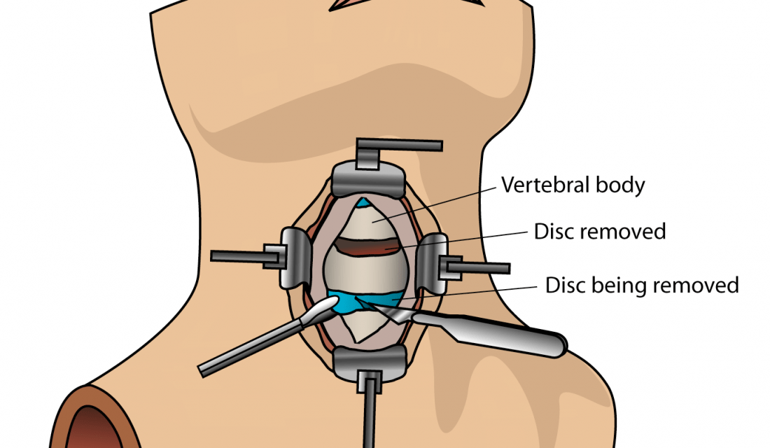 https://www.southerncrescent.com.my/wp-content/uploads/2021/02/Neck-Surgery-1100x640.png