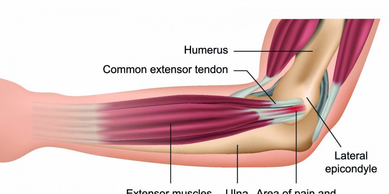 https://www.southerncrescent.com.my/wp-content/uploads/2021/02/Tenis-Elbow-1280x640.jpg
