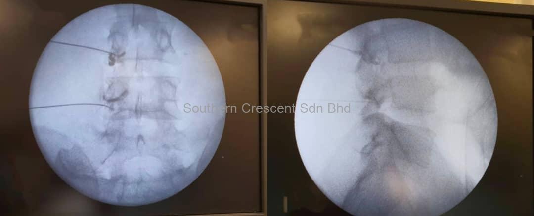 https://www.southerncrescent.com.my/wp-content/uploads/2021/03/RF-L4L5-4.jpeg