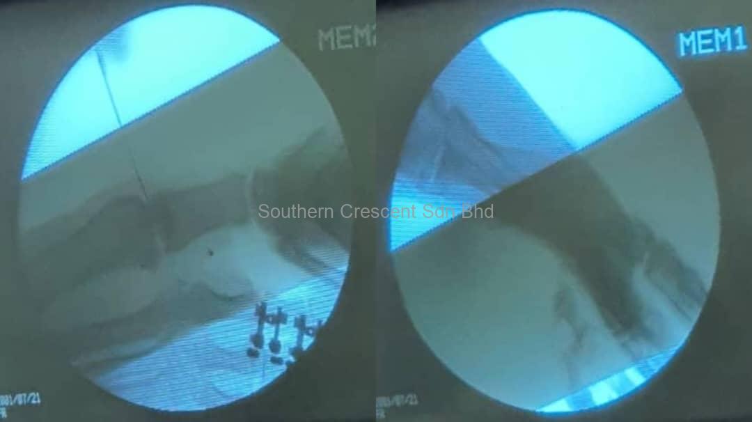 https://www.southerncrescent.com.my/wp-content/uploads/2021/03/RF-Toe-4.jpeg