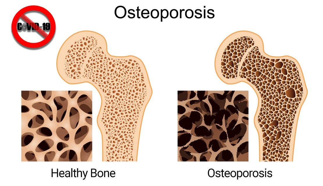 https://www.southerncrescent.com.my/wp-content/uploads/2021/10/WOMEN-CHILDREN-FACE-HIGH-RISK-OF-DEVELOPING-OSTEOPOROSIS-SOUTHERN-CRESCENT-SDN-BHD-NEGERI-SEMBILAN-WHATSAPP-0199199334-1110x640.jpeg